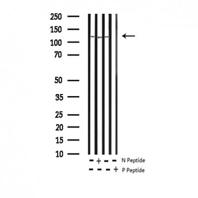 AF3398 staining HepG2 by IF/ICC. The sample were fixed with PFA and permeabilized in 0.1% Triton X-100,then blocked in 10% serum for 45 minutes at 25¡ãC. The primary antibody was diluted at 1/200 and incubated with the sample for 1 hour at 37¡ãC. An  Alexa Fluor 594 conjugated goat anti-rabbit IgG (H+L) Ab, diluted at 1/600, was used as the secondary antibod