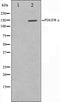 Western blot analysis on 293 cell lysate using PDGFRalpha Antibody,The lane on the left is treated with the antigen-specific peptide.