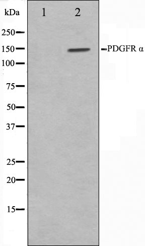 Western blot analysis on 293 cell lysate using PDGFRalpha Antibody,The lane on the left is treated with the antigen-specific peptide.