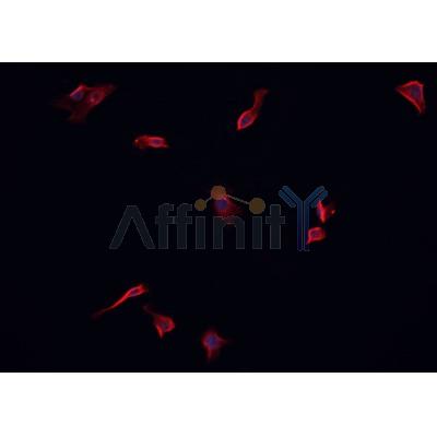 AF0241 staining CACO-2 cells by IF/ICC. The sample were fixed with PFA and permeabilized in 0.1% Triton X-100,then blocked in 10% serum for 45 minutes at 25¡ãC. The primary antibody was diluted at 1/200 and incubated with the sample for 1 hour at 37¡ãC. An  Alexa Fluor 594 conjugated goat anti-rabbit IgG (H+L) antibody(Cat.