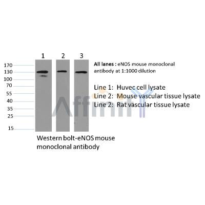 Western blot analysis of eNOS mouse monoclonal antibody expression in HuvEc, Mouse vascular and Rat vascular cell/tissue lysates.