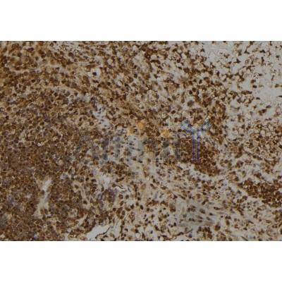 AF0013 at 1/100 staining Human spleen tissue by IHC-P. The sample was formaldehyde fixed and a heat mediated antigen retrieval step in citrate buffer was performed. The sample was then blocked and incubated with the antibody for 1.5 hours at 22¡ãC. An HRP conjugated goat anti-rabbit antibody was used as the secondary