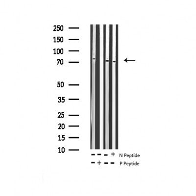 AF3412 staining A431 by IF/ICC. The sample were fixed with PFA and permeabilized in 0.1% Triton X-100,then blocked in 10% serum for 45 minutes at 25¡ãC. The primary antibody was diluted at 1/200 and incubated with the sample for 1 hour at 37¡ãC. An  Alexa Fluor 594 conjugated goat anti-rabbit IgG (H+L) Ab, diluted at 1/600, was used as the secondary antibod