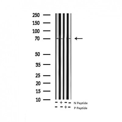 AF3413 staining A431 by IF/ICC. The sample were fixed with PFA and permeabilized in 0.1% Triton X-100,then blocked in 10% serum for 45 minutes at 25¡ãC. The primary antibody was diluted at 1/200 and incubated with the sample for 1 hour at 37¡ãC. An  Alexa Fluor 594 conjugated goat anti-rabbit IgG (H+L) Ab, diluted at 1/600, was used as the secondary antibod