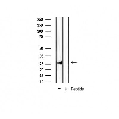 AF3414 staining 293 by IF/ICC. The sample were fixed with PFA and permeabilized in 0.1% Triton X-100,then blocked in 10% serum for 45 minutes at 25¡ãC. The primary antibody was diluted at 1/200 and incubated with the sample for 1 hour at 37¡ãC. An  Alexa Fluor 594 conjugated goat anti-rabbit IgG (H+L) Ab, diluted at 1/600, was used as the secondary antibod
