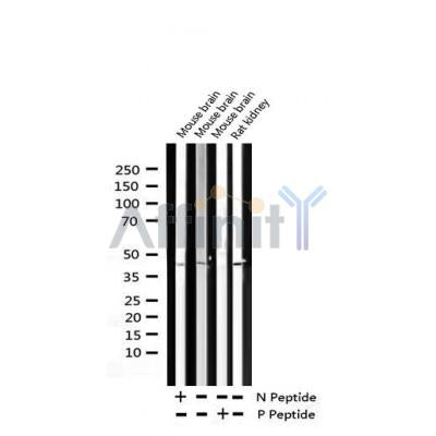 AF3447 staining HeLa by IF/ICC. The sample were fixed with PFA and permeabilized in 0.1% Triton X-100,then blocked in 10% serum for 45 minutes at 25¡ãC. The primary antibody was diluted at 1/200 and incubated with the sample for 1 hour at 37¡ãC. An  Alexa Fluor 594 conjugated goat anti-rabbit IgG (H+L) Ab, diluted at 1/600, was used as the secondary antibod