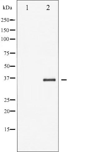 AF3448 staining HeLa by IF/ICC. The sample were fixed with PFA and permeabilized in 0.1% Triton X-100,then blocked in 10% serum for 45 minutes at 25¡ãC. The primary antibody was diluted at 1/200 and incubated with the sample for 1 hour at 37¡ãC. An  Alexa Fluor 594 conjugated goat anti-rabbit IgG (H+L) Ab, diluted at 1/600, was used as the secondary antibod