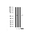 Western blot analysis of Peripherin expression in Mouse brain lysate