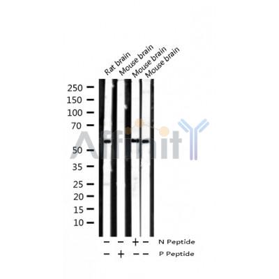 Western blot analysis of extracts from rat brain, mouse muscle, using Phospho-Smad2 (Ser467) Antibody.