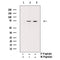 AF3450 staining HepG2 by IF/ICC. The sample were fixed with PFA and permeabilized in 0.1% Triton X-100,then blocked in 10% serum for 45 minutes at 25¡ãC. The primary antibody was diluted at 1/200 and incubated with the sample for 1 hour at 37¡ãC. An  Alexa Fluor 594 conjugated goat anti-rabbit IgG (H+L) Ab, diluted at 1/600, was used as the secondary antibod