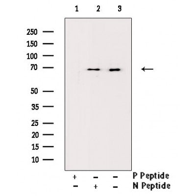 AF3450 staining HepG2 by IF/ICC. The sample were fixed with PFA and permeabilized in 0.1% Triton X-100,then blocked in 10% serum for 45 minutes at 25¡ãC. The primary antibody was diluted at 1/200 and incubated with the sample for 1 hour at 37¡ãC. An  Alexa Fluor 594 conjugated goat anti-rabbit IgG (H+L) Ab, diluted at 1/600, was used as the secondary antibod