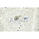Western blot analysis of extracts from 293, using ATPase Antibody. Lane 1 was treated with the blocking peptide.
