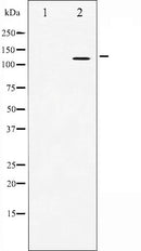 AF6084 at 1/100 staining Rat brain tissue by IHC-P. The sample was formaldehyde fixed and a heat mediated antigen retrieval step in citrate buffer was performed. The sample was then blocked and incubated with the antibody for 1.5 hours at 22¡ãC. An HRP conjugated goat anti-rabbit antibody was used as the secondary