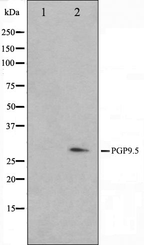 Western blot analysis on 293 cell lysate using PGP9.5 Antibody,The lane on the left is treated with the antigen-specific peptide.
