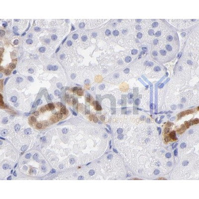 AF0243 at 1/100 staining Human kidney  tissue by IHC-P. The sample was formaldehyde fixed and a heat mediated antigen retrieval step in citrate buffer was performed. The sample was then blocked and incubated with the antibody for 1.5 hours at 22¡ãC. An HRP conjugated goat anti-rabbit antibody was used as the secondary