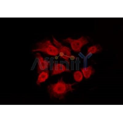 AF0243 staining 293 by IF/ICC. The sample were fixed with PFA and permeabilized in 0.1% Triton X-100,then blocked in 10% serum for 45 minutes at 25¡ãC. The primary antibody was diluted at 1/200 and incubated with the sample for 1 hour at 37¡ãC. An  Alexa Fluor 594 conjugated goat anti-rabbit IgG (H+L) Ab, diluted at 1/600, was used as the secondary antibod