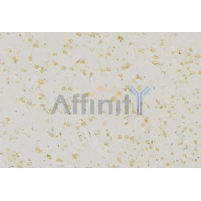 AF0243 at 1/100 staining Mouse brain tissue by IHC-P. The sample was formaldehyde fixed and a heat mediated antigen retrieval step in citrate buffer was performed. The sample was then blocked and incubated with the antibody for 1.5 hours at 22¡ãC. An HRP conjugated goat anti-rabbit antibody was used as the secondary