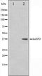 Western blot analysis on HuvEc cell lysate using hnRPD Antibody.The lane on the left is treated with the antigen-specific peptide.