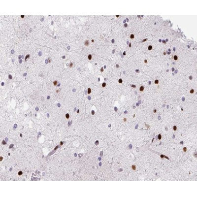 AF0092 at 1/200 staining human brain tissue sections by IHC-P. The tissue was formaldehyde fixed and a heat mediated antigen retrieval step in citrate buffer was performed. The tissue was then blocked and incubated with the antibody for 1.5 hours at 22¡ãC. An HRP conjugated goat anti-rabbit antibody was used as the secondary
