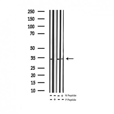 AF3415 staining 293 by IF/ICC. The sample were fixed with PFA and permeabilized in 0.1% Triton X-100,then blocked in 10% serum for 45 minutes at 25¡ãC. The primary antibody was diluted at 1/200 and incubated with the sample for 1 hour at 37¡ãC. An  Alexa Fluor 594 conjugated goat anti-rabbit IgG (H+L) Ab, diluted at 1/600, was used as the secondary antibod