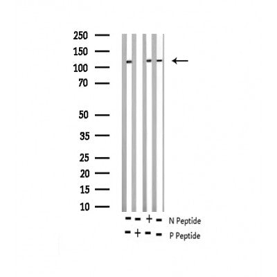 AF3420 staining HeLa by IF/ICC. The sample were fixed with PFA and permeabilized in 0.1% Triton X-100,then blocked in 10% serum for 45 minutes at 25¡ãC. The primary antibody was diluted at 1/200 and incubated with the sample for 1 hour at 37¡ãC. An  Alexa Fluor 594 conjugated goat anti-rabbit IgG (H+L) Ab, diluted at 1/600, was used as the secondary antibod