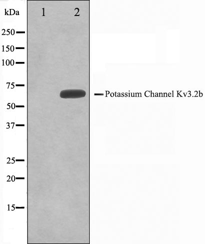 Western blot analysis on HepG2 cell lysate using KCNC2 Antibody,The lane on the left is treated with the antigen-specific peptide.