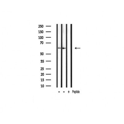 AF3422 staining HT29 by IF/ICC. The sample were fixed with PFA and permeabilized in 0.1% Triton X-100,then blocked in 10% serum for 45 minutes at 25¡ãC. The primary antibody was diluted at 1/200 and incubated with the sample for 1 hour at 37¡ãC. An  Alexa Fluor 594 conjugated goat anti-rabbit IgG (H+L) Ab, diluted at 1/600, was used as the secondary antibod