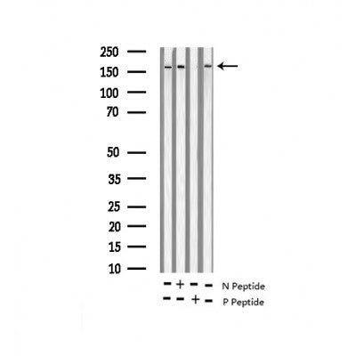 AF3425 at 1/100 staining Human liver cancer tissue by IHC-P. The sample was formaldehyde fixed and a heat mediated antigen retrieval step in citrate buffer was performed. The sample was then blocked and incubated with the antibody for 1.5 hours at 22¡ãC. An HRP conjugated goat anti-rabbit antibody was used as the secondary