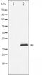 AF3428 staining HepG2 by IF/ICC. The sample were fixed with PFA and permeabilized in 0.1% Triton X-100,then blocked in 10% serum for 45 minutes at 25¡ãC. The primary antibody was diluted at 1/200 and incubated with the sample for 1 hour at 37¡ãC. An  Alexa Fluor 594 conjugated goat anti-rabbit IgG (H+L) Ab, diluted at 1/600, was used as the secondary antibod