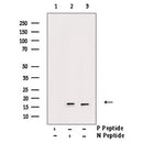 AF3430 staining COS7 by IF/ICC. The sample were fixed with PFA and permeabilized in 0.1% Triton X-100,then blocked in 10% serum for 45 minutes at 25¡ãC. The primary antibody was diluted at 1/200 and incubated with the sample for 1 hour at 37¡ãC. An  Alexa Fluor 594 conjugated goat anti-rabbit IgG (H+L) Ab, diluted at 1/600, was used as the secondary antibod