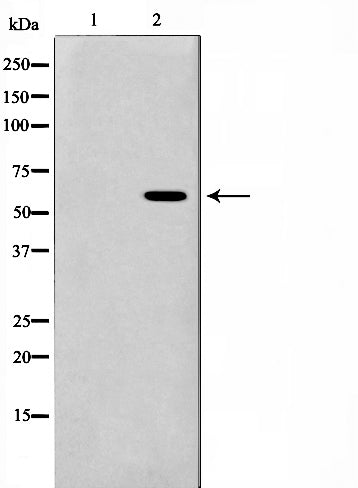 Western blot analysis on RAW264.7 cell lysate using Presenilin 1 Antibody,The lane on the left is treated with the antigen-specific peptide.
