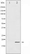AF3432 staining Hela by IF/ICC. The sample were fixed with PFA and permeabilized in 0.1% Triton X-100,then blocked in 10% serum for 45 minutes at 25¡ãC. The primary antibody was diluted at 1/200 and incubated with the sample for 1 hour at 37¡ãC. An  Alexa Fluor 594 conjugated goat anti-rabbit IgG (H+L) Ab, diluted at 1/600, was used as the secondary antibod