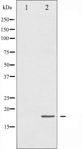 AF3432 staining Hela by IF/ICC. The sample were fixed with PFA and permeabilized in 0.1% Triton X-100,then blocked in 10% serum for 45 minutes at 25¡ãC. The primary antibody was diluted at 1/200 and incubated with the sample for 1 hour at 37¡ãC. An  Alexa Fluor 594 conjugated goat anti-rabbit IgG (H+L) Ab, diluted at 1/600, was used as the secondary antibod