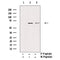 AF3435 staining HuvEc by IF/ICC. The sample were fixed with PFA and permeabilized in 0.1% Triton X-100,then blocked in 10% serum for 45 minutes at 25¡ãC. The primary antibody was diluted at 1/200 and incubated with the sample for 1 hour at 37¡ãC. An  Alexa Fluor 594 conjugated goat anti-rabbit IgG (H+L) Ab, diluted at 1/600, was used as the secondary antibod