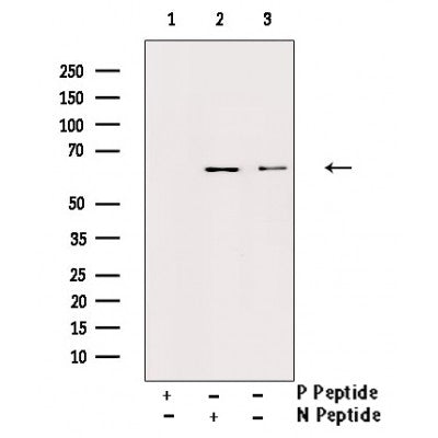 AF3435 staining HuvEc by IF/ICC. The sample were fixed with PFA and permeabilized in 0.1% Triton X-100,then blocked in 10% serum for 45 minutes at 25¡ãC. The primary antibody was diluted at 1/200 and incubated with the sample for 1 hour at 37¡ãC. An  Alexa Fluor 594 conjugated goat anti-rabbit IgG (H+L) Ab, diluted at 1/600, was used as the secondary antibod