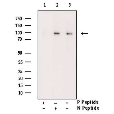 Western blot analysis of Phospho-Kv2.1 (Ser805) Antibody expression in TNF treated K562 cells lysates.The lane on the right is treated with the antigen-specific peptide.