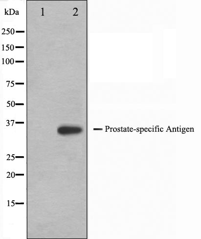 Western blot analysis on mouse heart cell lysate using KLK3 Antibody,The lane on the left is treated with the antigen-specific peptide.