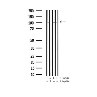 AF3444 staining A549 cells by IF/ICC. The sample were fixed with PFA and permeabilized in 0.1% Triton X-100,then blocked in 10% serum for 45 minutes at 25¡ãC. The primary antibody was diluted at 1/200 and incubated with the sample for 1 hour at 37¡ãC. An  Alexa Fluor 594 conjugated goat anti-rabbit IgG (H+L) antibody(Cat.