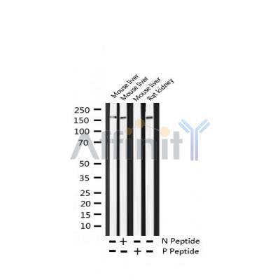 AF3445 at 1/100 staining Mouse kidney tissue by IHC-P. The sample was formaldehyde fixed and a heat mediated antigen retrieval step in citrate buffer was performed. The sample was then blocked and incubated with the antibody for 1.5 hours at 22¡ãC. An HRP conjugated goat anti-rabbit antibody was used as the secondary