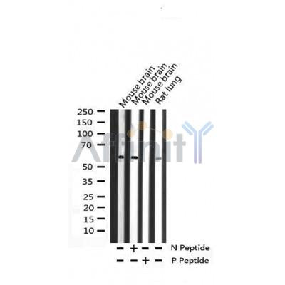 AF3451 staining HeLa by IF/ICC. The sample were fixed with PFA and permeabilized in 0.1% Triton X-100,then blocked in 10% serum for 45 minutes at 25¡ãC. The primary antibody was diluted at 1/200 and incubated with the sample for 1 hour at 37¡ãC. An  Alexa Fluor 594 conjugated goat anti-rabbit IgG (H+L) Ab, diluted at 1/600, was used as the secondary antibod