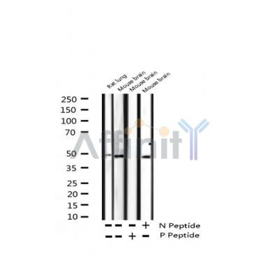 AF3455 staining Hela by IF/ICC. The sample were fixed with PFA and permeabilized in 0.1% Triton X-100,then blocked in 10% serum for 45 minutes at 25¡ãC. The primary antibody was diluted at 1/200 and incubated with the sample for 1 hour at 37¡ãC. An  Alexa Fluor 594 conjugated goat anti-rabbit IgG (H+L) Ab, diluted at 1/600, was used as the secondary antibod
