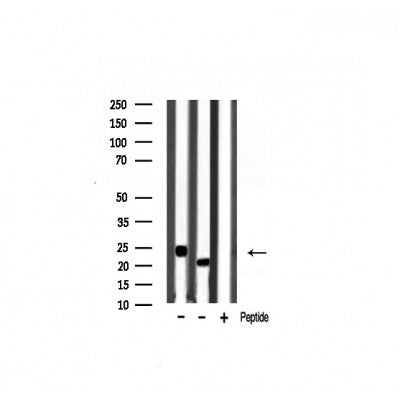 Western blot analysis of RASH/RASK/RASN expression in various lysates