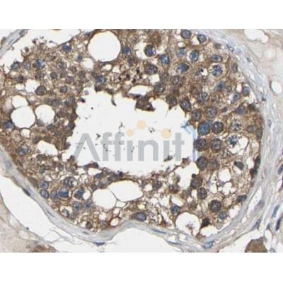 RASH/RASK/RASN Antibody