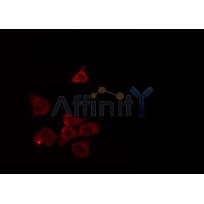 AF0247 staining HeLa by IF/ICC. The sample were fixed with PFA and permeabilized in 0.1% Triton X-100,then blocked in 10% serum for 45 minutes at 25¡ãC. The primary antibody was diluted at 1/200 and incubated with the sample for 1 hour at 37¡ãC. An  Alexa Fluor 594 conjugated goat anti-rabbit IgG (H+L) Ab, diluted at 1/600, was used as the secondary antibod