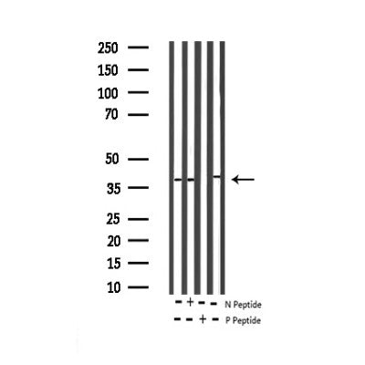 AF3457 staining Hela by IF/ICC. The sample were fixed with PFA and permeabilized in 0.1% Triton X-100,then blocked in 10% serum for 45 minutes at 25¡ãC. The primary antibody was diluted at 1/200 and incubated with the sample for 1 hour at 37¡ãC. An  Alexa Fluor 594 conjugated goat anti-rabbit IgG (H+L) Ab, diluted at 1/600, was used as the secondary antibod