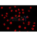 AF0248 staining LOVO by IF/ICC. The sample were fixed with PFA and permeabilized in 0.1% Triton X-100,then blocked in 10% serum for 45 minutes at 25¡ãC. The primary antibody was diluted at 1/200 and incubated with the sample for 1 hour at 37¡ãC. An  Alexa Fluor 594 conjugated goat anti-rabbit IgG (H+L) Ab, diluted at 1/600, was used as the secondary antibod