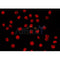 AF0248 staining LOVO by IF/ICC. The sample were fixed with PFA and permeabilized in 0.1% Triton X-100,then blocked in 10% serum for 45 minutes at 25¡ãC. The primary antibody was diluted at 1/200 and incubated with the sample for 1 hour at 37¡ãC. An  Alexa Fluor 594 conjugated goat anti-rabbit IgG (H+L) Ab, diluted at 1/600, was used as the secondary antibod