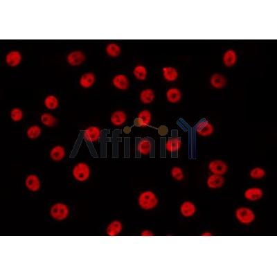 AF0248 staining LOVO by IF/ICC. The sample were fixed with PFA and permeabilized in 0.1% Triton X-100,then blocked in 10% serum for 45 minutes at 25¡ãC. The primary antibody was diluted at 1/200 and incubated with the sample for 1 hour at 37¡ãC. An  Alexa Fluor 594 conjugated goat anti-rabbit IgG (H+L) Ab, diluted at 1/600, was used as the secondary antibod