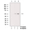 AF3467 staining COLO205 cells by IF/ICC. The sample were fixed with PFA and permeabilized in 0.1% Triton X-100,then blocked in 10% serum for 45 minutes at 25¡ãC. The primary antibody was diluted at 1/200 and incubated with the sample for 1 hour at 37¡ãC. An  Alexa Fluor 594 conjugated goat anti-rabbit IgG (H+L) antibody(Cat.