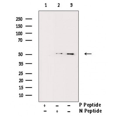 AF3467 staining COLO205 cells by IF/ICC. The sample were fixed with PFA and permeabilized in 0.1% Triton X-100,then blocked in 10% serum for 45 minutes at 25¡ãC. The primary antibody was diluted at 1/200 and incubated with the sample for 1 hour at 37¡ãC. An  Alexa Fluor 594 conjugated goat anti-rabbit IgG (H+L) antibody(Cat.